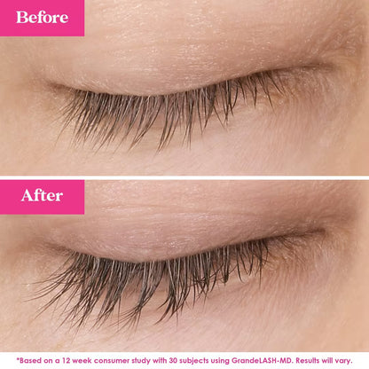 Lash & Brow Essentials Bundle – Limited Edition