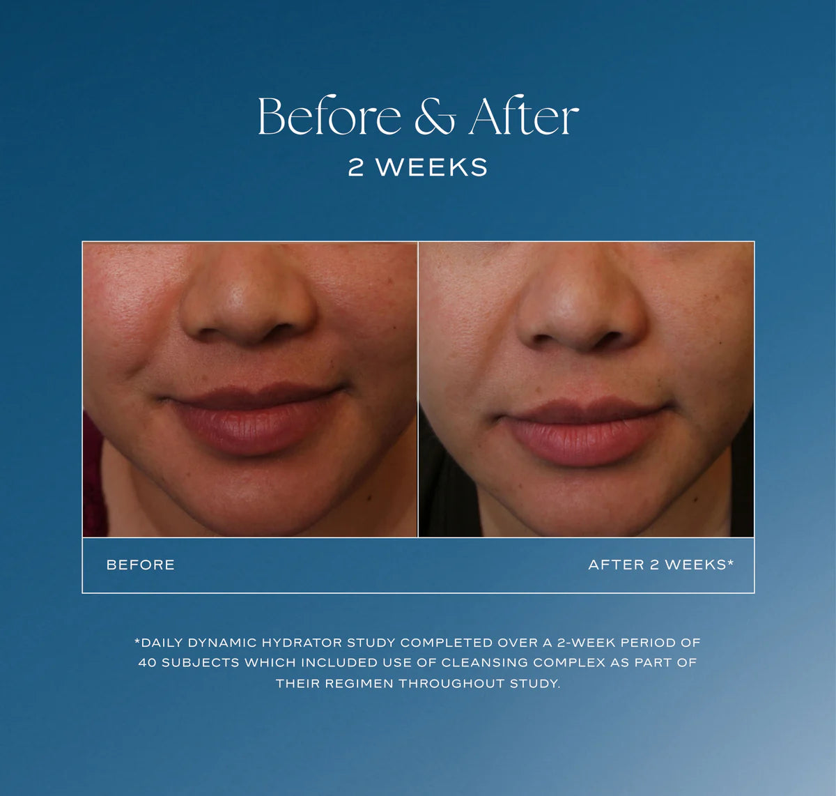 Before and after skin hydration comparison with a blue background