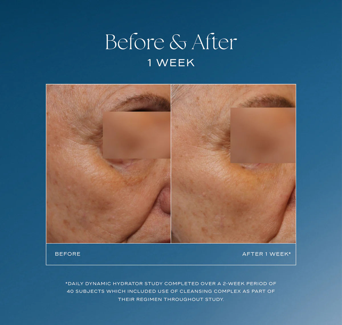 Before and after skin treatment comparison on a blue background