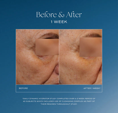 Before and after skin treatment comparison on a blue background