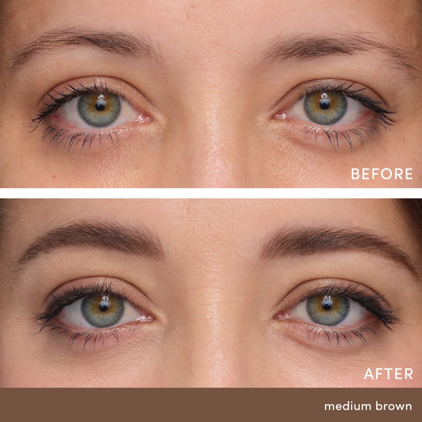 Before and after comparison of eyes with medium brown coloration.