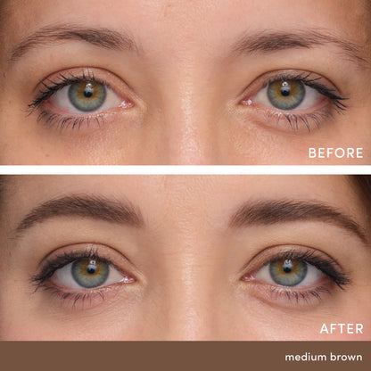 Before and after comparison of eyes with medium brown coloration.