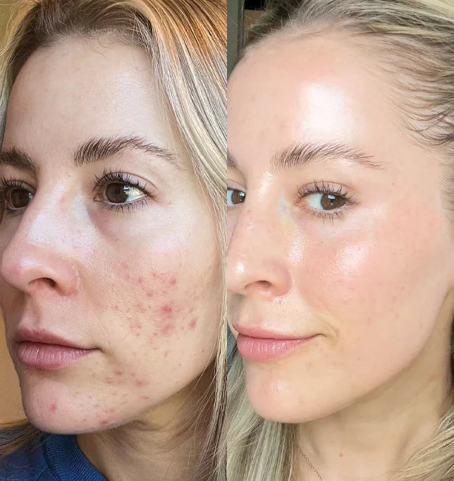 BOUNCEBACK Fine Lines Serum