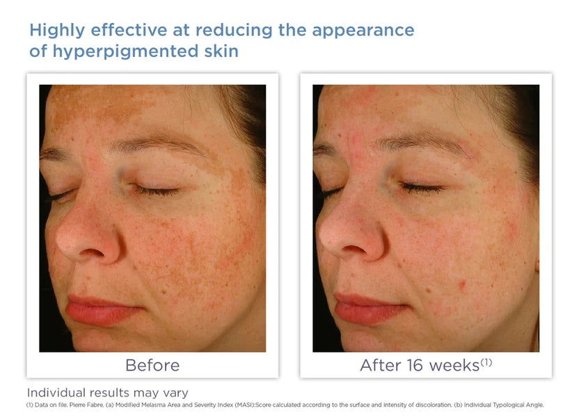 Enhance Brightening Complex