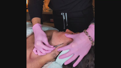 Classic Dermaplane
