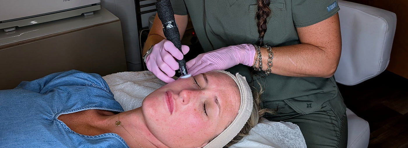 Caroline performing ProCell microchanneling at a client's temple at Skin By Caroline in Rock Hill, SC