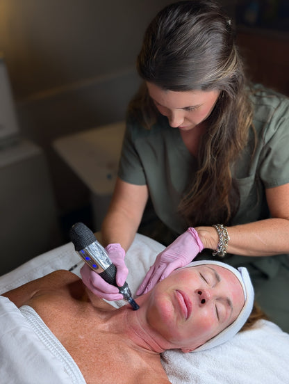 Caroline microneedling a client's cheek in the treatment room in Rock Hill, SC