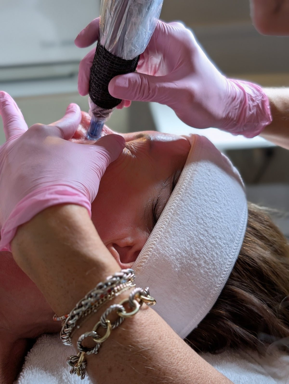 Close view of the microneedling pen at the client's brow, skin held taut with a gloved hand